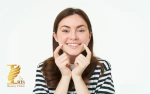 تزریق ژل خط خنده
