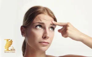 تزریق ژل خط اخم