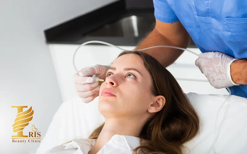 کربوکسی تراپی زیر چشم