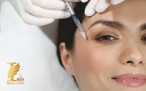 بوتاکس چشم گربه ای