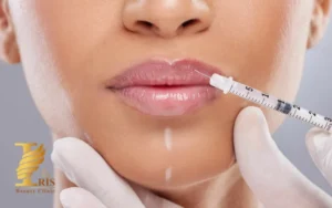 مراقبت های بعد از تزریق ژل لب
