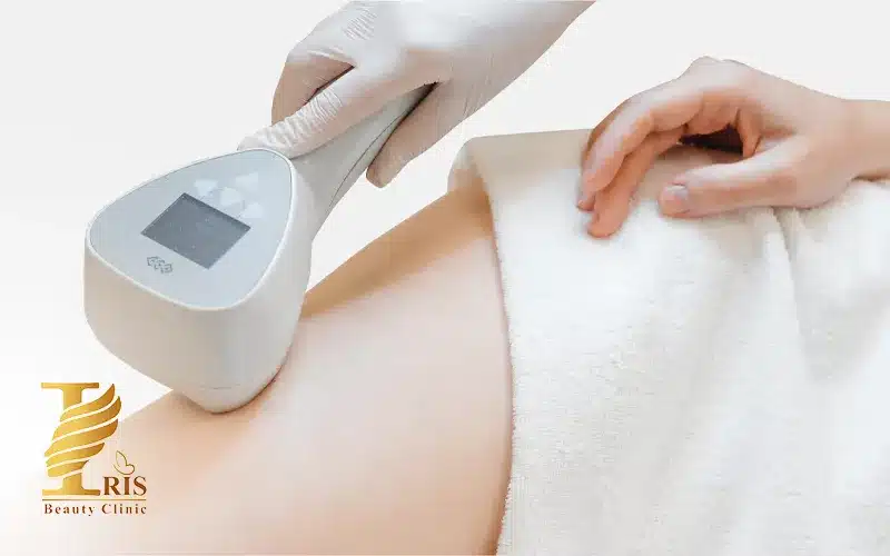 تفاوت IPL با لیزر
