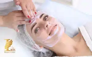 کربوکسی تراپی در فیشیال
