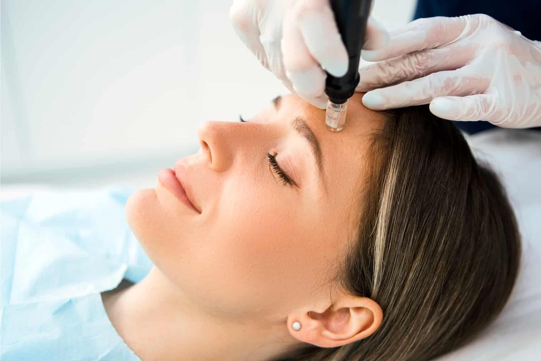 مراقبت های بعد از میکرونیدلینگ