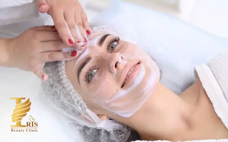 کربوکسی تراپی در فیشیال