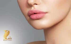 تزریق ژل لب مدل قلبی