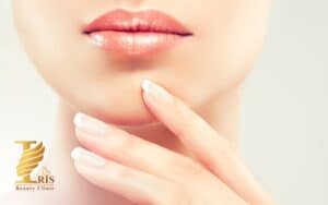 تزریق ژل لب مدل نچرال