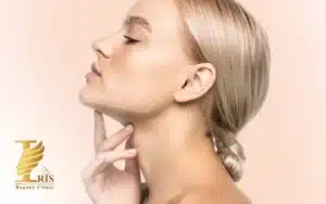 زاویه سازی صورت با ژل