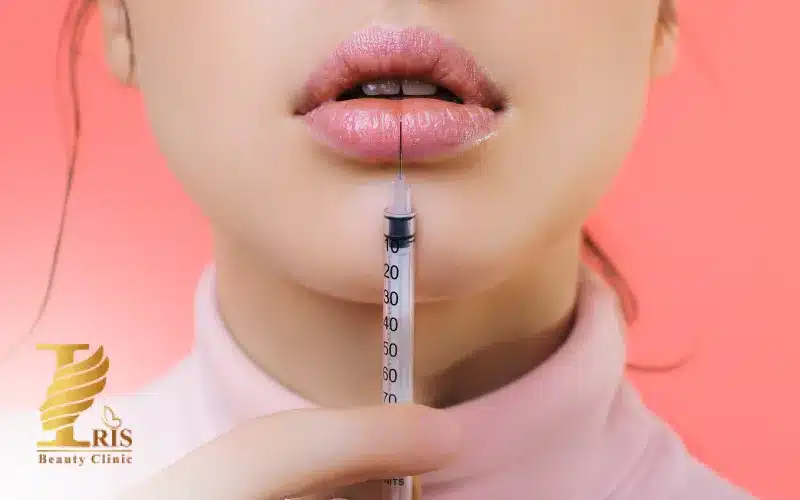 هزینه تزریق ژل لب