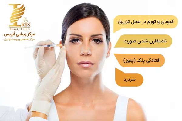 نکات مهم بوتاکس