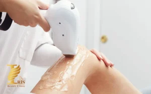 عوارض لیزر برای پوست