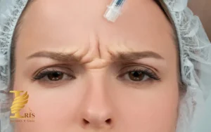 بوتاکس