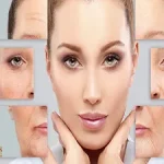 مراقبت پس از تزریق بوتاکس