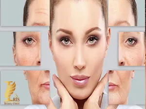 مراقبت پس از تزریق بوتاکس
