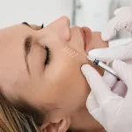مراقبت پس از تزریق ژل‌فیلر