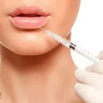 ژل‌فیلر