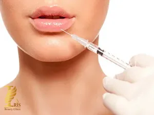 ژل‌فیلر