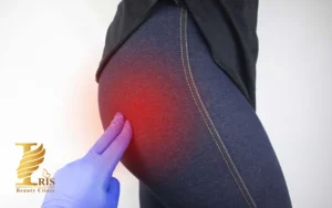 مقایسه فیلر باسن و پروتز