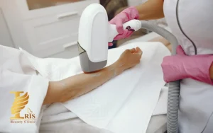 دستگاه لیزر کندلا