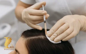 تجربه بعد از مزوتراپی مو
