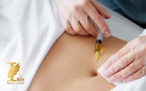 تعداد جلسات مزوتراپی لاغری